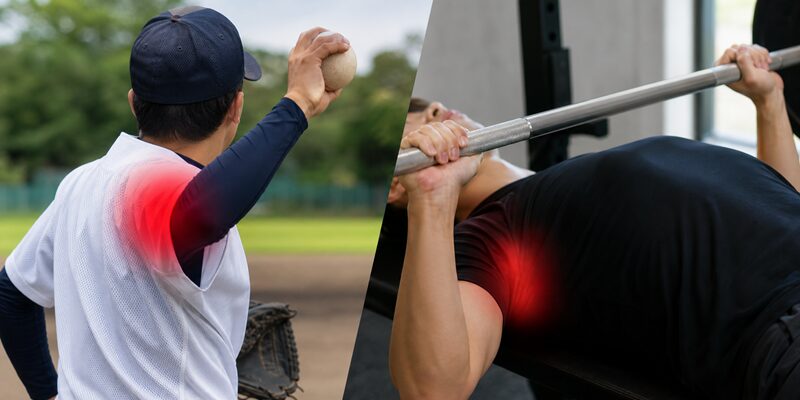 【症例】野球肩とベンチプレスの関係とは？痛みの原因と正しい治療法